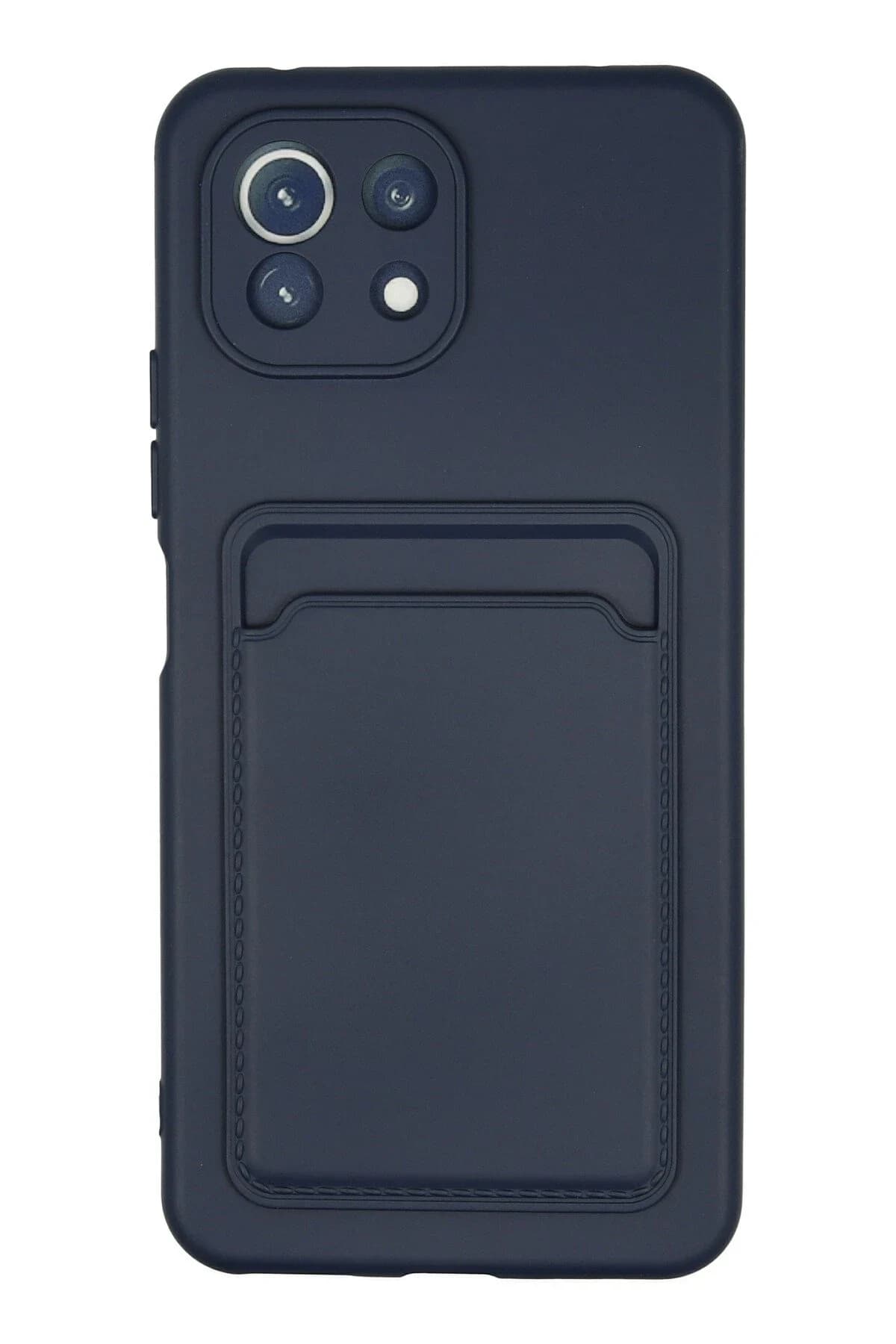 uryport Xiaomi Mİ 11 Lite Kılıf Kelvin Kartvizitli Silikon - Lacivert